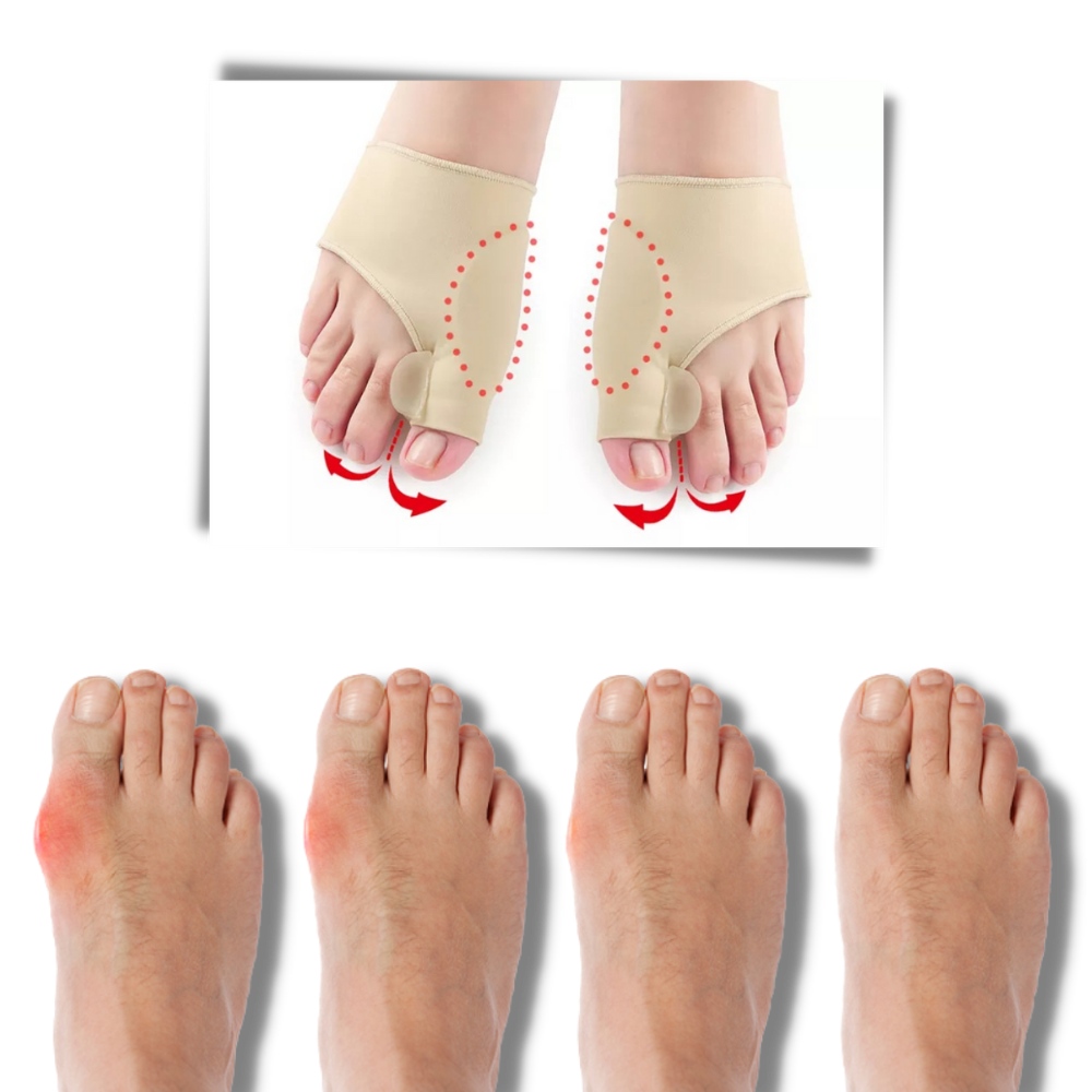 Gel hallux valgus justering