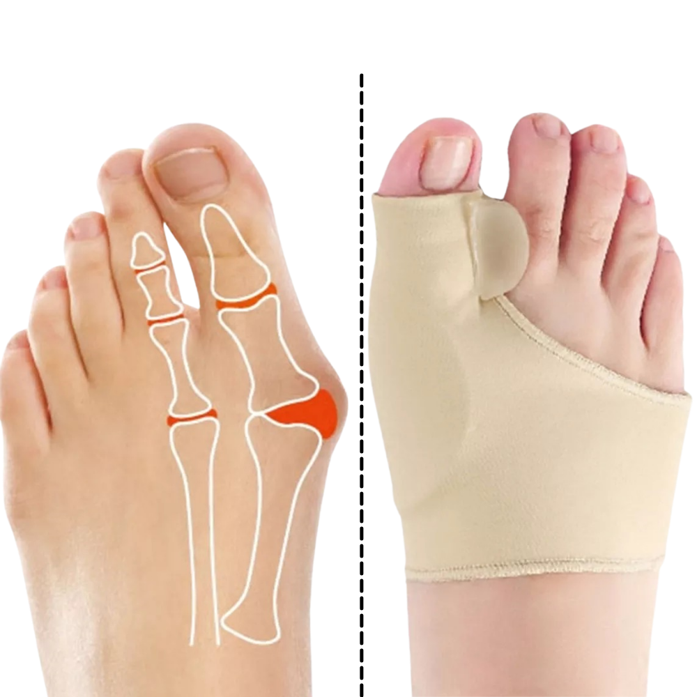 Gel hallux valgus justering