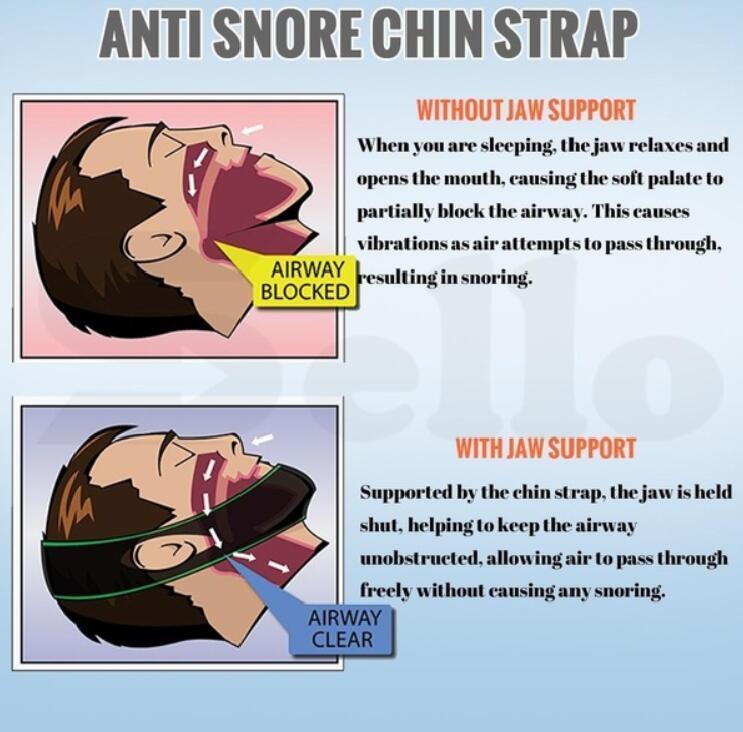 Norvo | Anti Snore Stop Snoring Kinnrem Belte