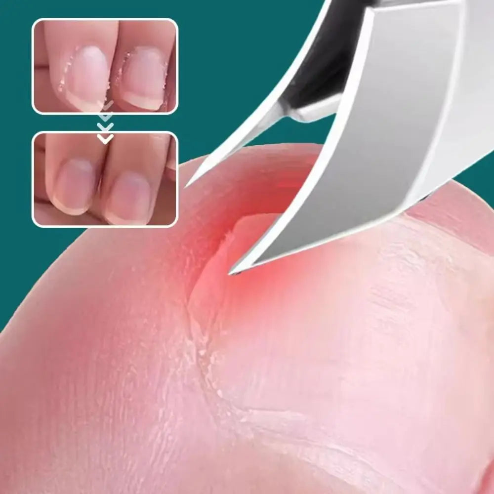 Norvo | Curved Edge Sharp Ingroddnegl Klipper