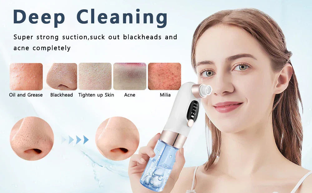 Norvo | Acne Black Head Deep Clean Removal