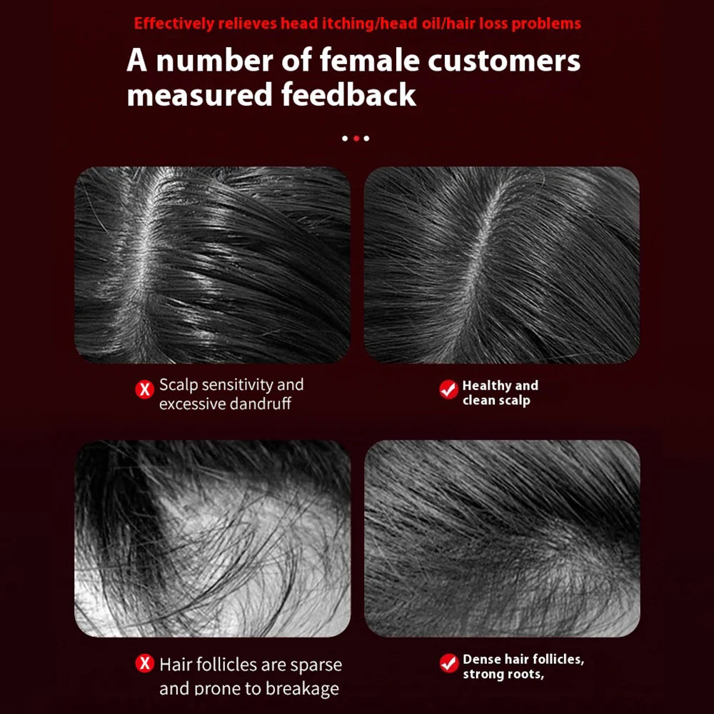 Norvo | Bærbar elektrisk hodebunnsmassasjebørste