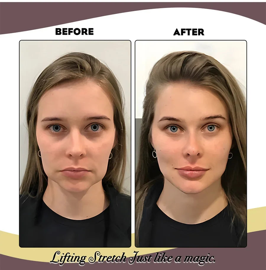 Norvo | Elastisk Ansiktsløftende Band