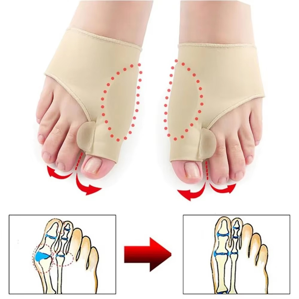 Norvo | Orthopedisk tåseparator og hallux valgus-korrektor for smertelindring og fotjustering