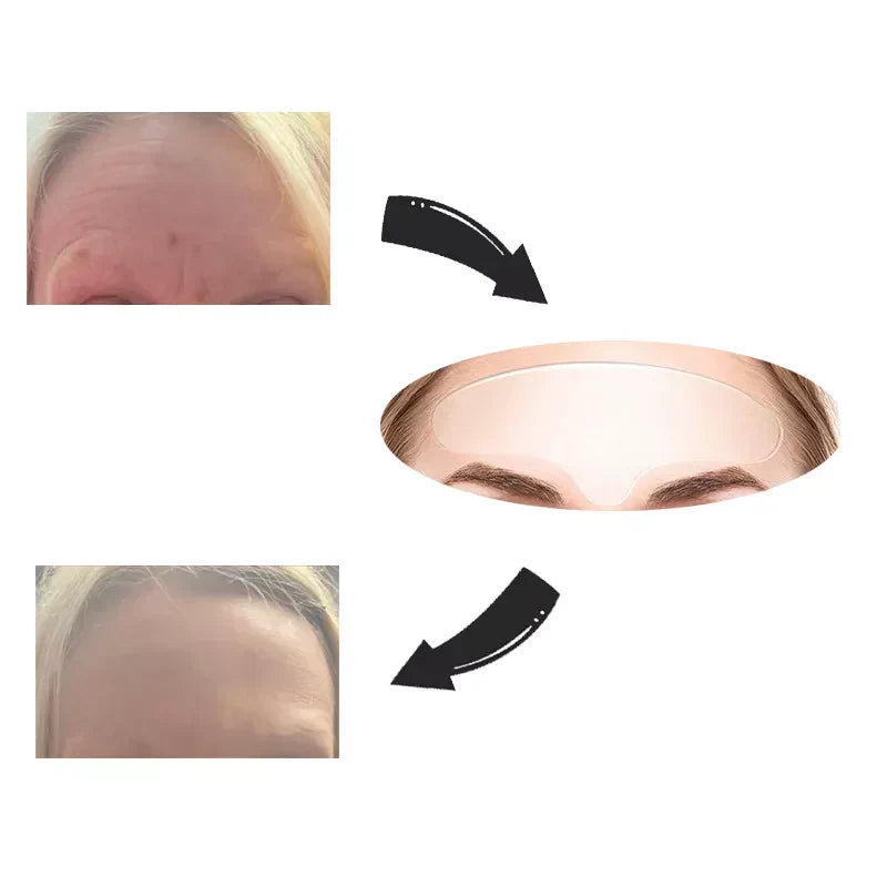 Norvo | Ansiktsløft Gjenbrukbart Tape