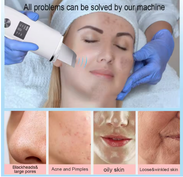 Norvo | SkinPure™ - Huden din er ditt visittkort, la det skinne som du fortjener!