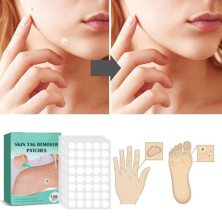 Norvo | SkinClear - Plaster for the removal of spots and warts