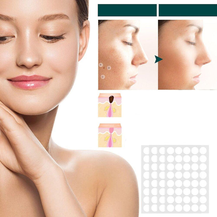 Norvo | SkinClear - Plaster for the removal of spots and warts