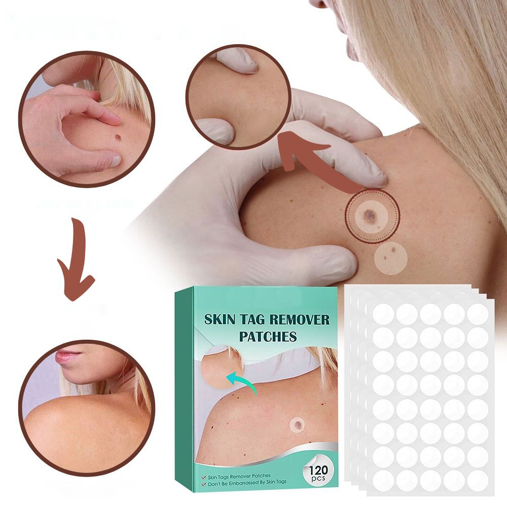 Norvo | SkinClear - Plaster for the removal of spots and warts