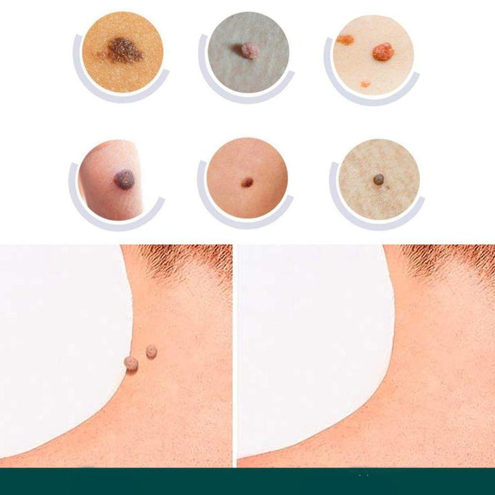 Norvo | SkinClear - Plaster for the removal of spots and warts