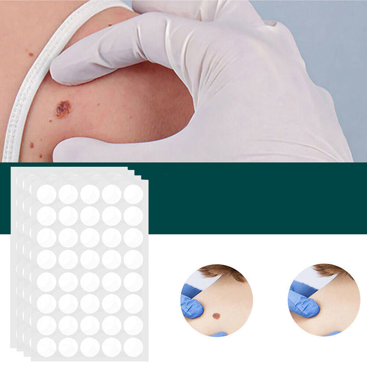 Norvo | SkinClear - Plaster for the removal of spots and warts