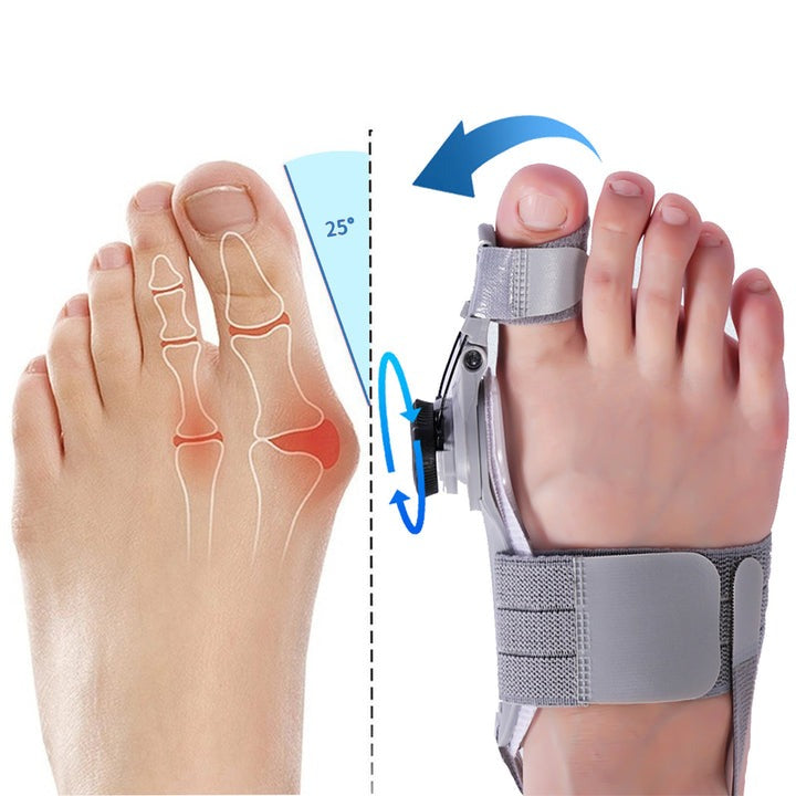 Norvo | Bunion Corrector Splint for Pain Relief and Alignment - Justerbar Fotstøtte for Hallux Valgus Behandling