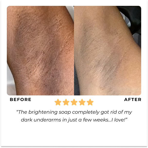 Norvo | Vitalume - Gurkemeie Lysnende Såpe (1+1 Gratis)