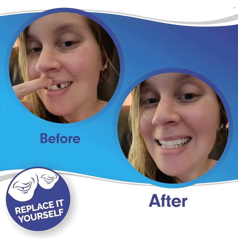 Norvo | Avtagbare Fyllinger Tanndekke