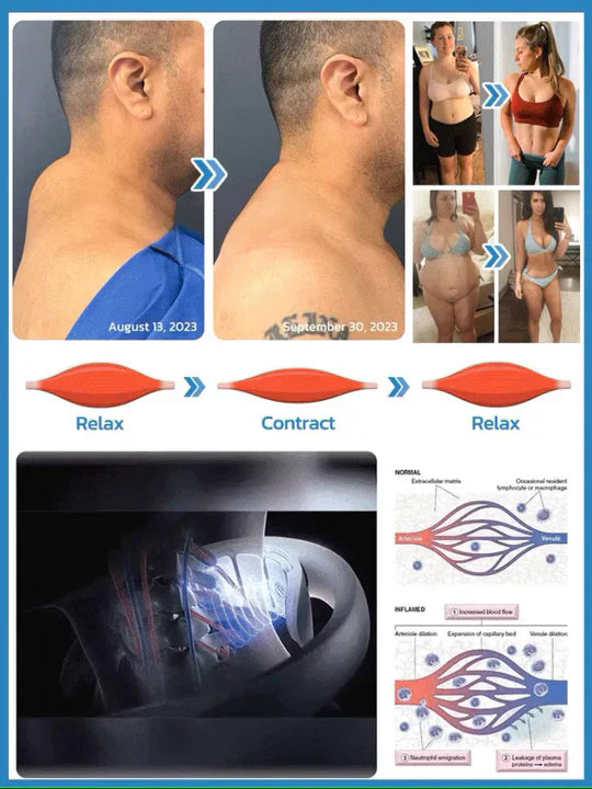 Norvo | Vitalize Ultralyd Lymfatisk Dreneringsutstyr for Cellulitt og Fettreduksjon Muskelavslapning