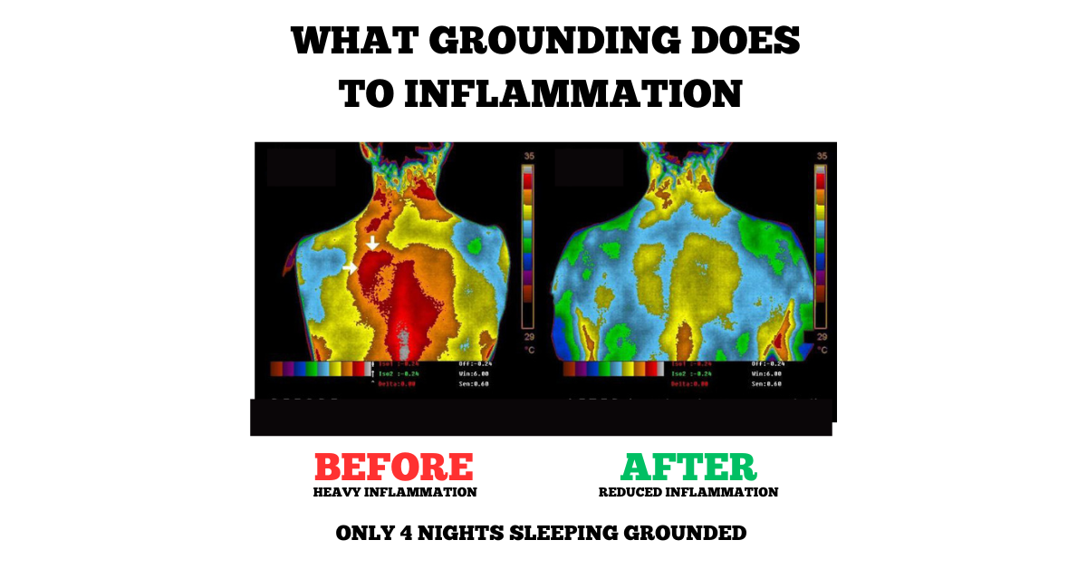 Norvo | Jordende Grunnlags Sove Matte - Jordende Undersheet Pad for Forbedret Søvnkvalitet Grunnlags Velvære Terapi