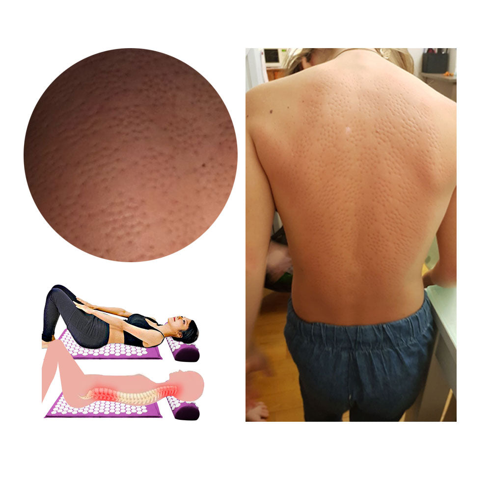 Norvo | Akupressur Yoga Matte & Pute Sett - RelaxMat