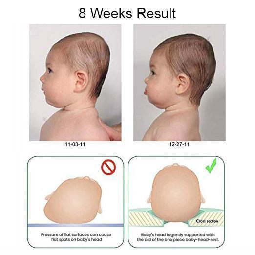 Norvo | Anti Flat Head Spedbarnpute