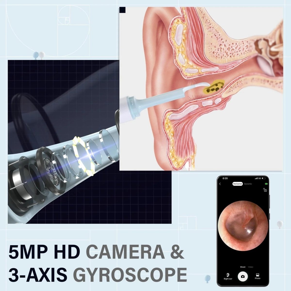 Norvo | AURIVIEW – Smart øre renser med HD kamera