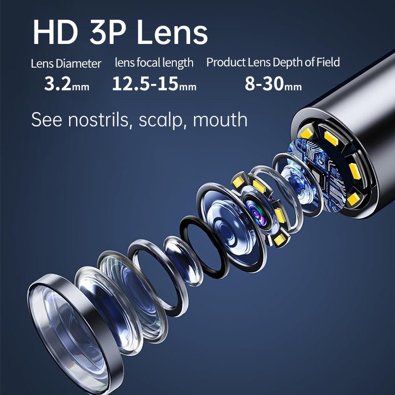 Norvo | AURIVIEW – Smart øre renser med HD kamera