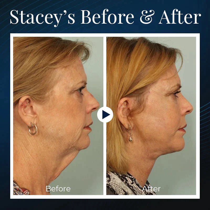 Norvo | BeautyRest+ Sovende V-Ansikt Skjønnhetsenhet