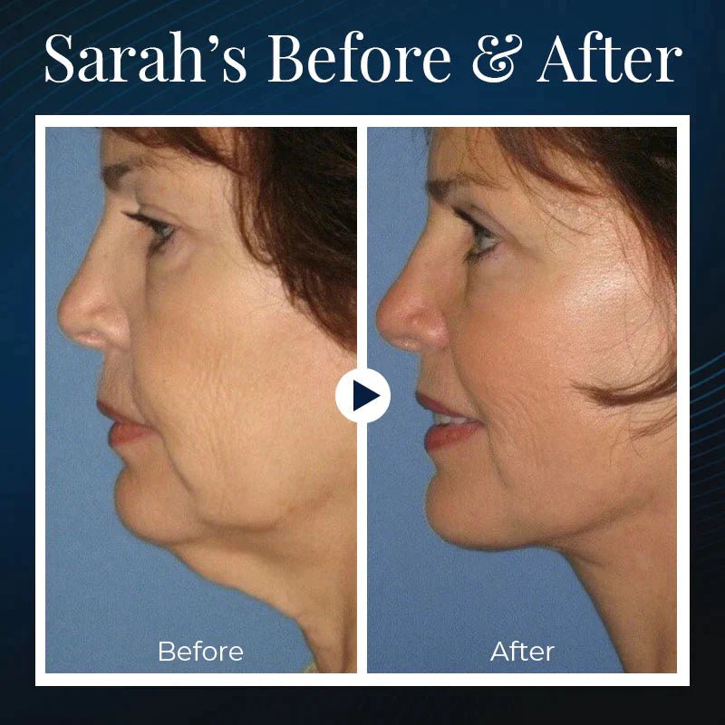 Norvo | BeautyRest+ Sovende V-Ansikt Skjønnhetsenhet