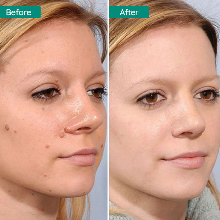 Norvo | Flytende Gressfrø Spray