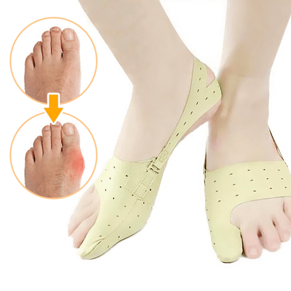 Norvo | Elastisk Bunion Korrigererfot Tå Hallux Ortopedisk Pleie
