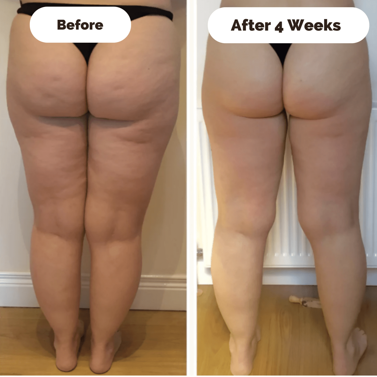 Norvo | DERMAGLOW – Hudfaste massasjeapparat for cellulitt