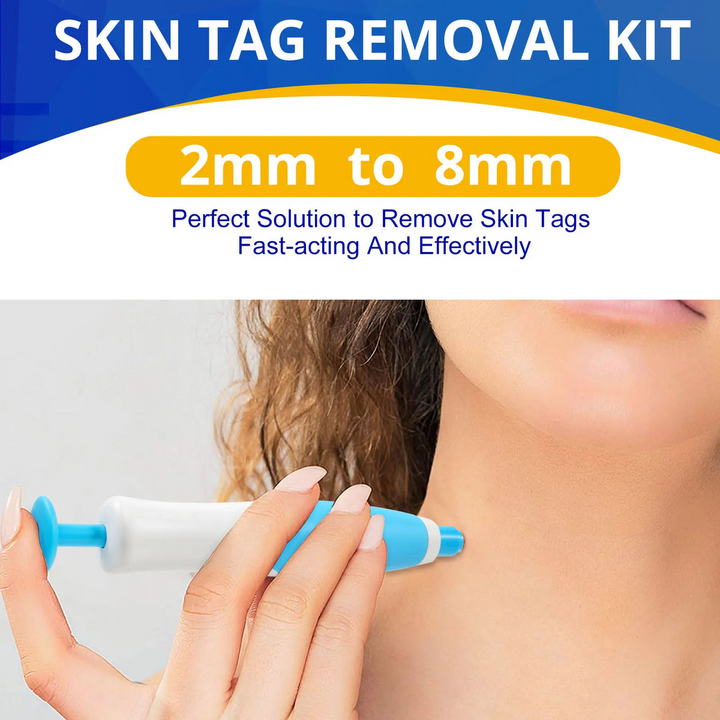Skin Tag Remover Kit | Ikke-invasiv & Effektiv | Norvo