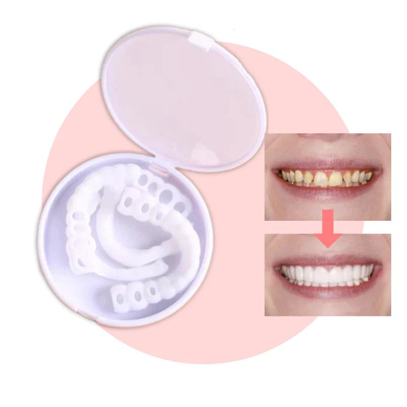 Norvo | Snap-on Teeth™ - Med disse fasettene, ha alltid det perfekte smilet