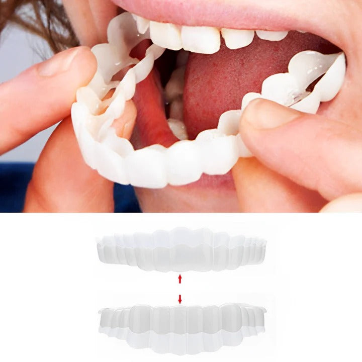 Norvo | Avtagbare Smile Veneers for Øvre og Nedre Tenner