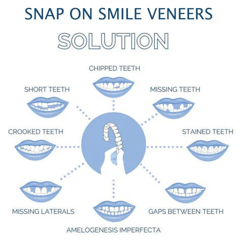 Norvo | Avtagbare Smile Veneers for Øvre og Nedre Tenner