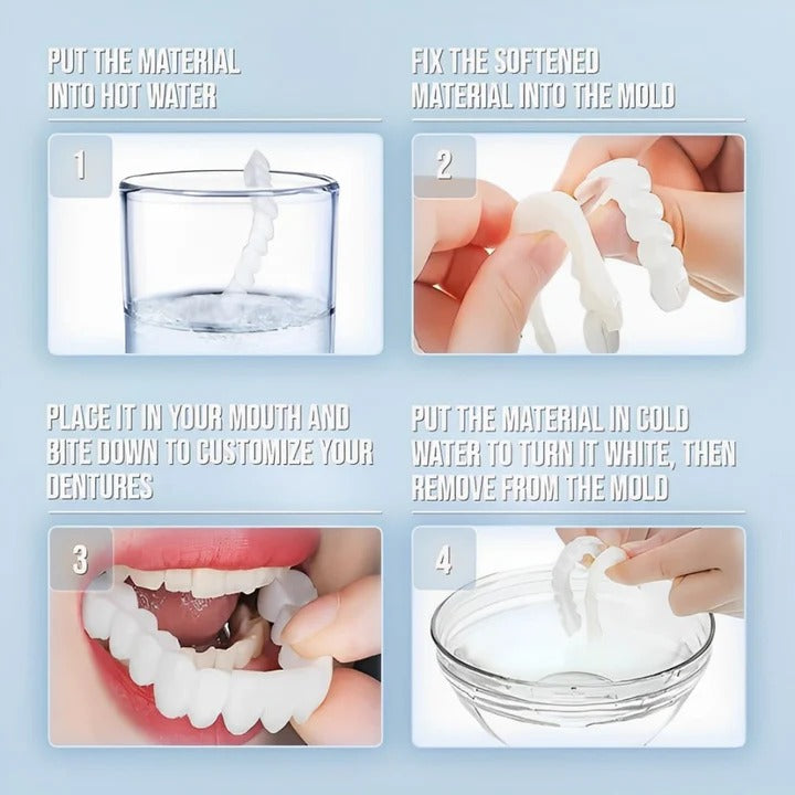 Norvo | Avtagbare Smile Veneers for Øvre og Nedre Tenner