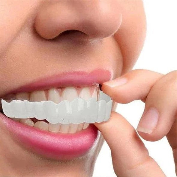Norvo | Avtagbare Smile Veneers for Øvre og Nedre Tenner