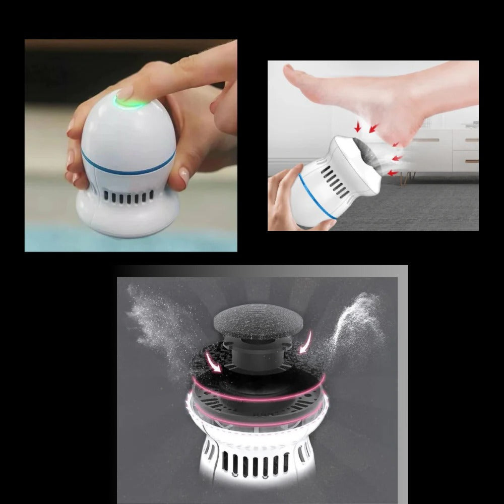 Norvo | Elektrisk Føtteskraper