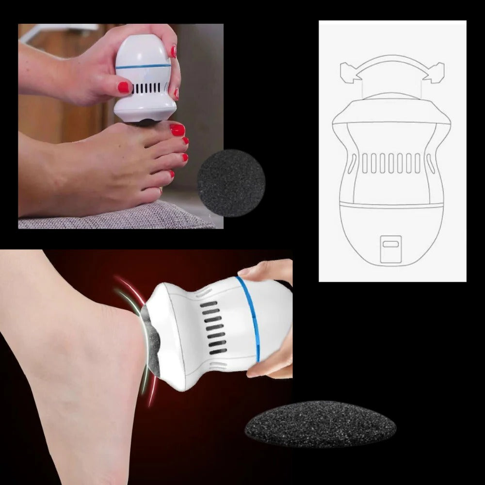 Norvo | Elektrisk Føtteskraper