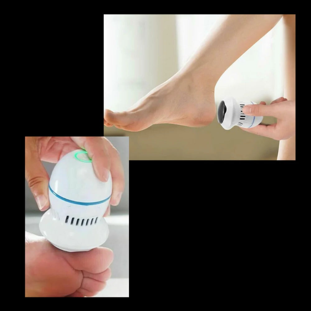 Norvo | Elektrisk Føtteskraper