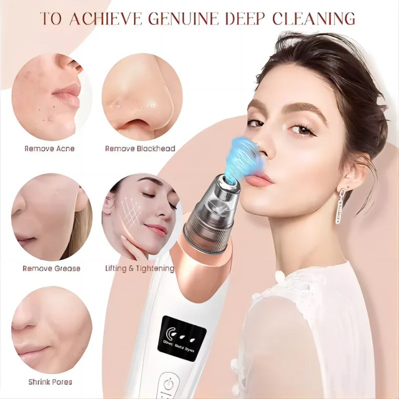 Norvo | Blackhead Remover Vacuum Pore Cleaner | Justerbart sug, multifunksjonelt verktøy for dyp rensing og aknebehandling hjemme