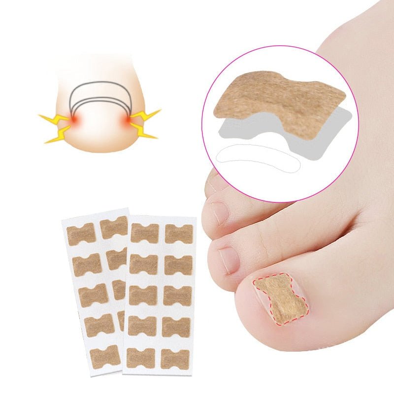 Norvo | Painless Toenail Patch - ToenailExpress