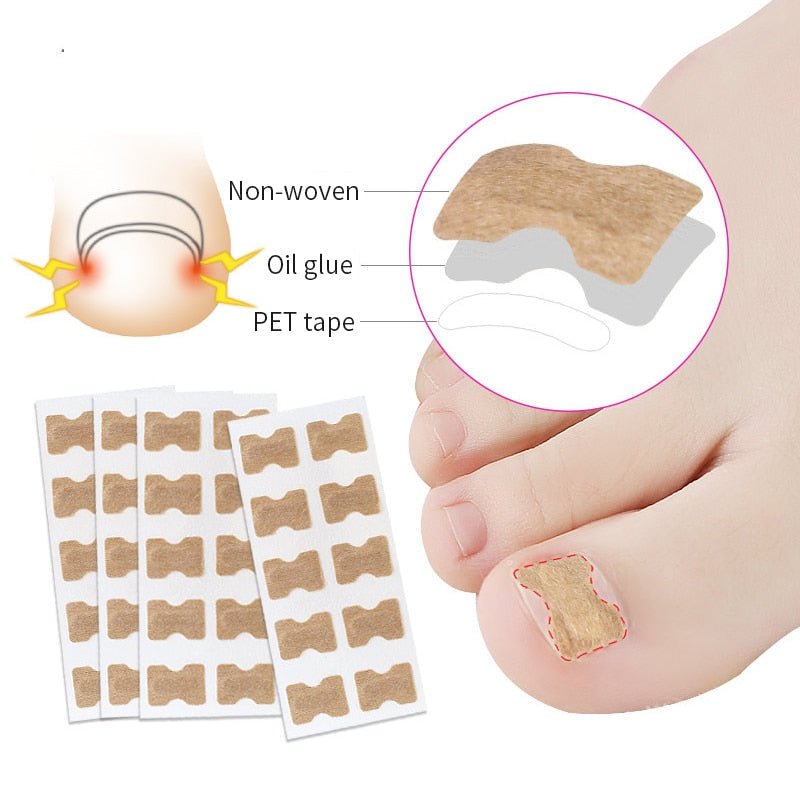 Norvo | Painless Toenail Patch - ToenailExpress