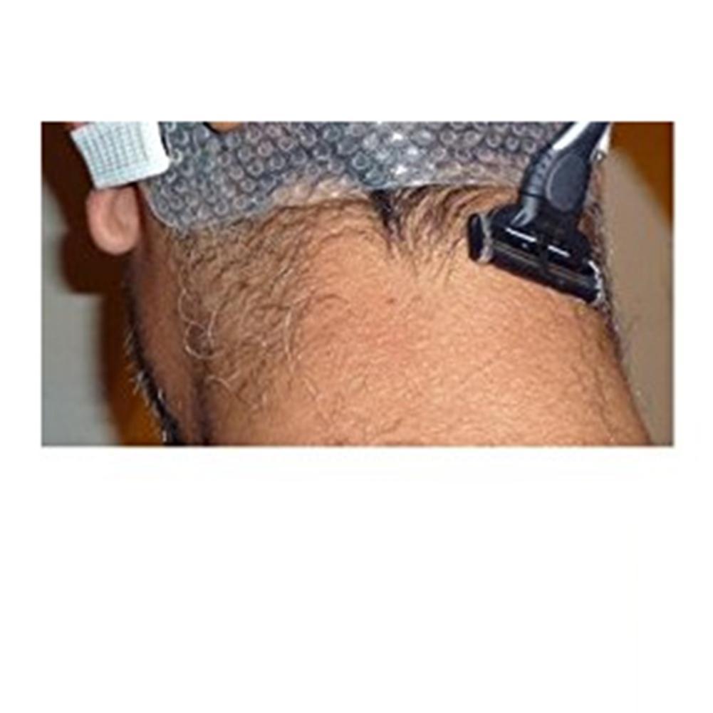 Norvo | Hårlinjeveiledning