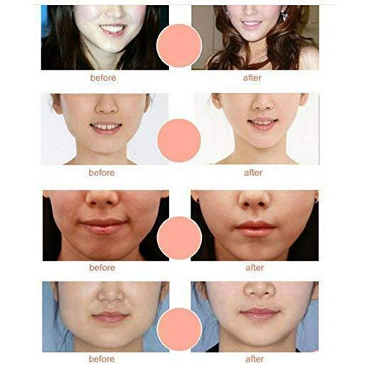 Norvo | V Linje Chin Up Ansiktsløft Maske