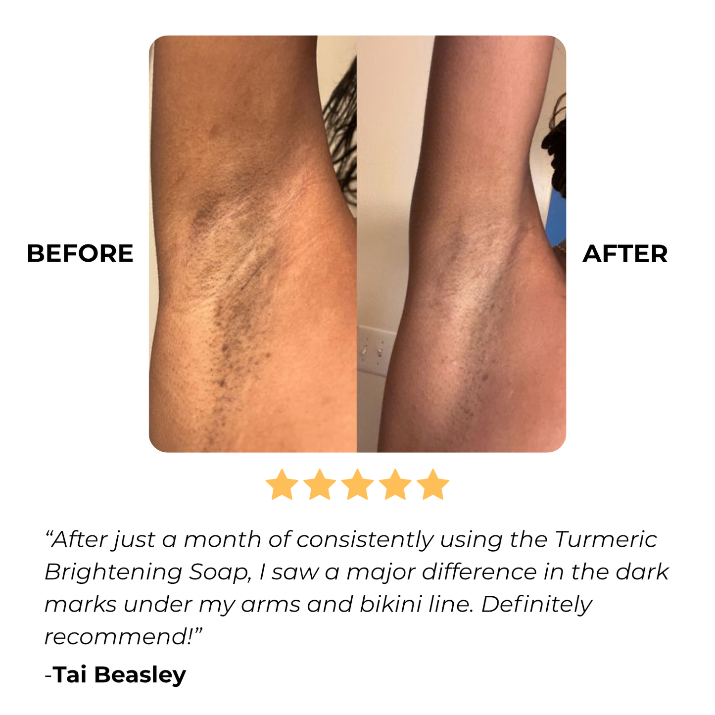 Norvo | Vitalume - Gurkemeie Lysnende Såpe (1+1 Gratis)