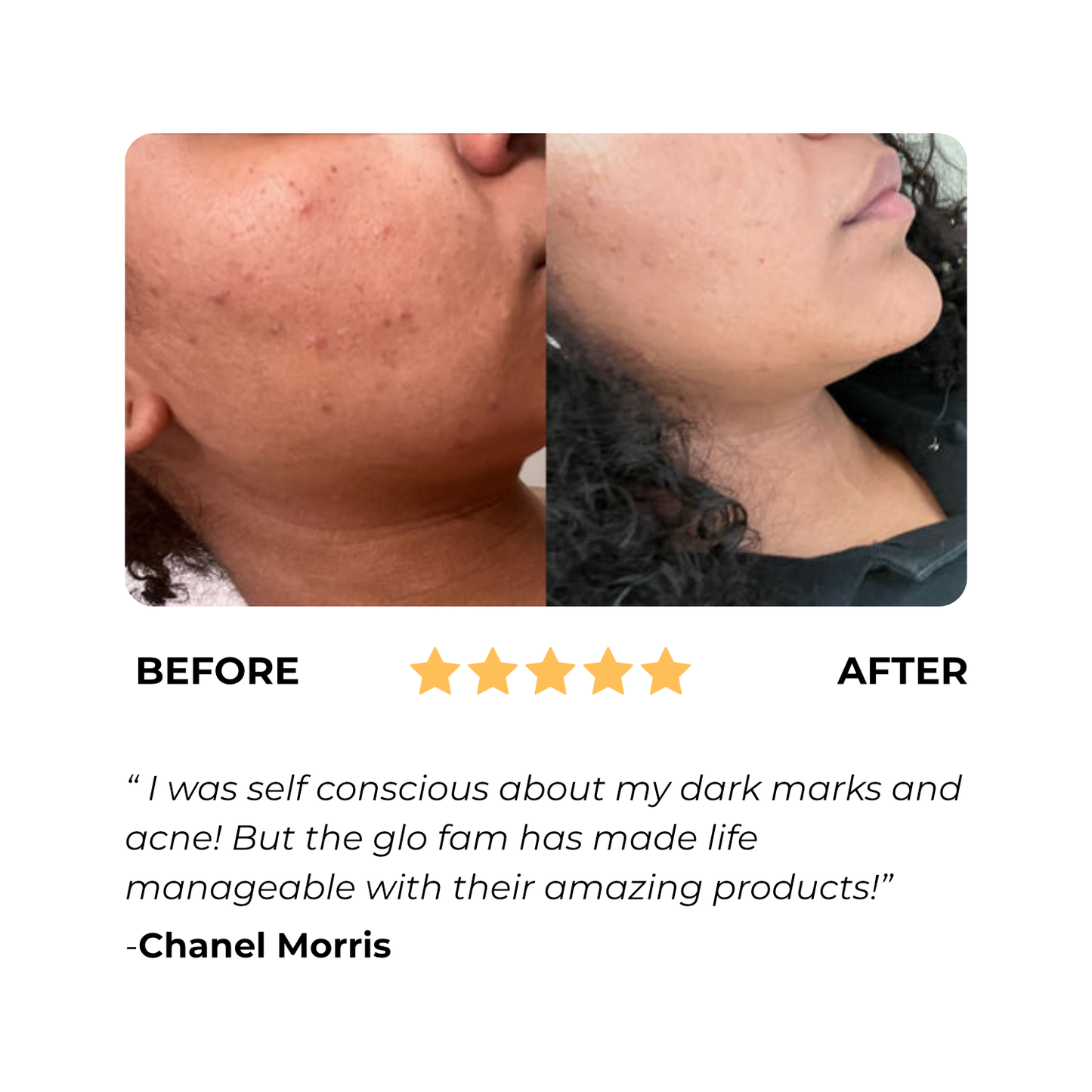 Norvo | Vitalume - Gurkemeie Lysnende Såpe (1+1 Gratis)