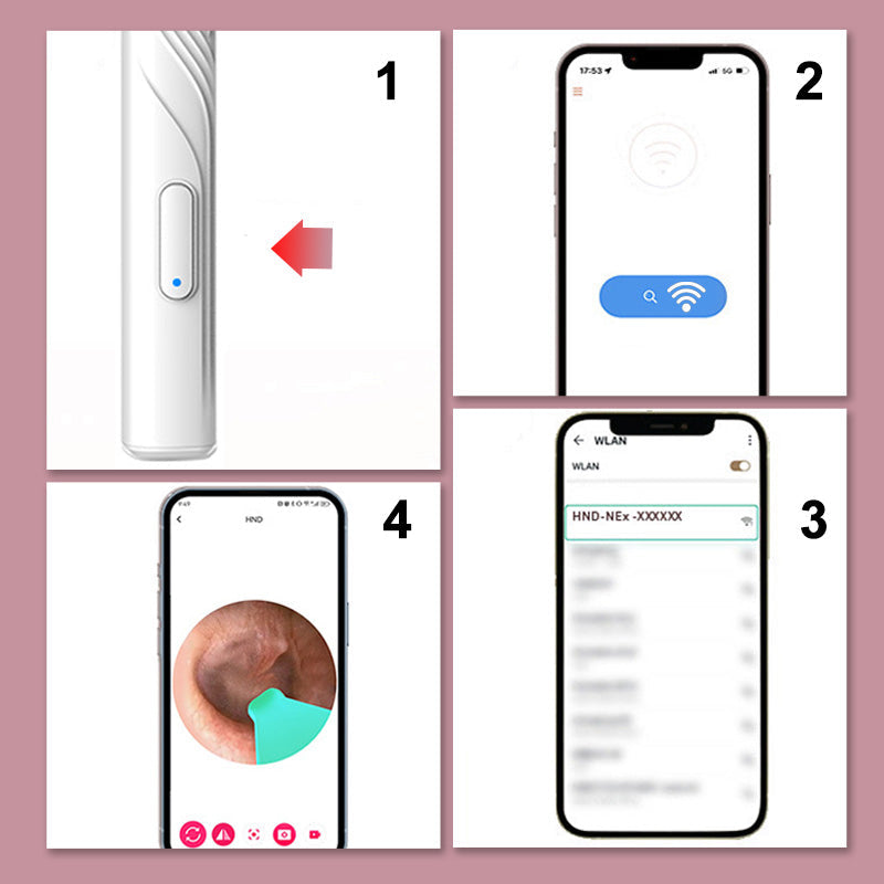 Norvo | Apparater for fjerning av ørevoks med HD-kamera